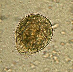 Balantidium is the largest single-celled parasite