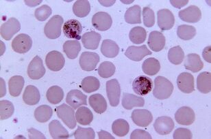 Plasmodium malaria