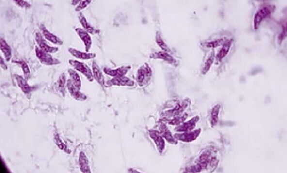 protozoan parasite toxoplasma gondii toxoplasmosis pathogen