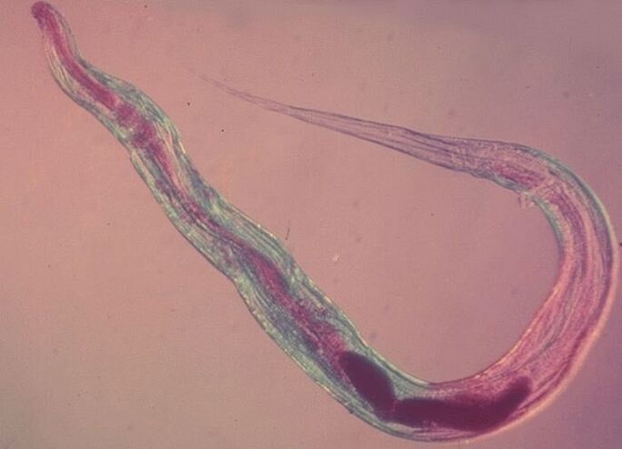 Pinworms under the microscope