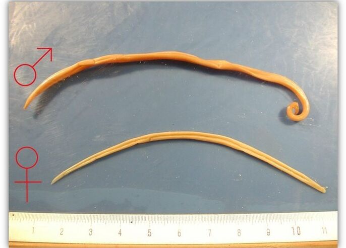 The size of roundworm - the type of worm that affects the respiratory tract of adults