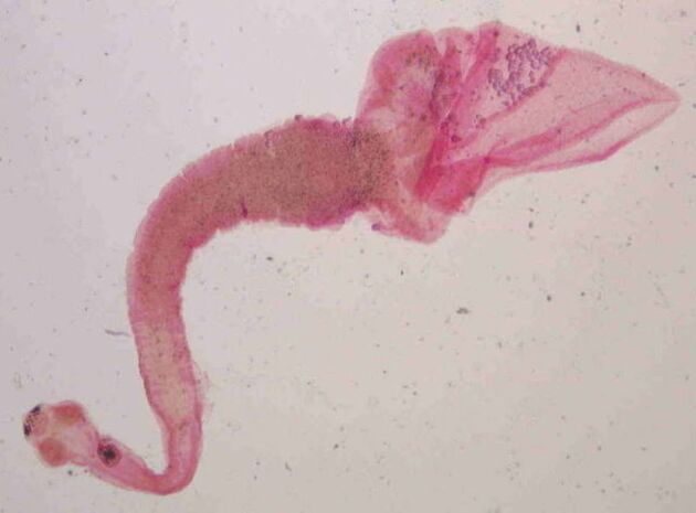 pork tapeworm from human body
