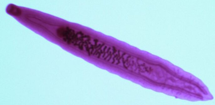 fluke parasites from the human body