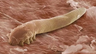 Parasites of the human body