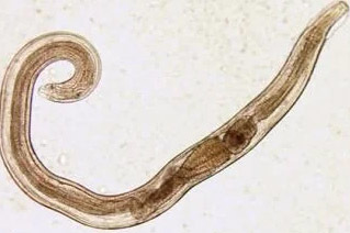 human parasitic tapeworm
